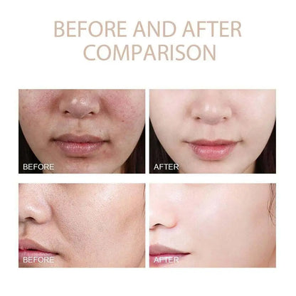 Radiant Revival Exfoliating Serum™